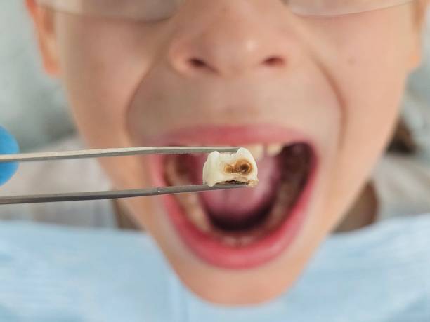 Best Weekend Emergency Dentist in Shafter, CA